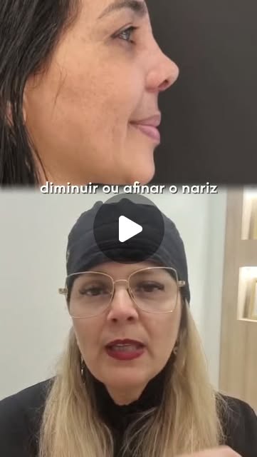 Não existe um nariz ideal. Existe o nariz que faz sentido para cada rosto.